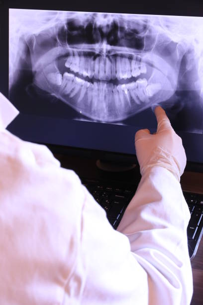 Best Emergency Tooth Extraction in Palacios, TX