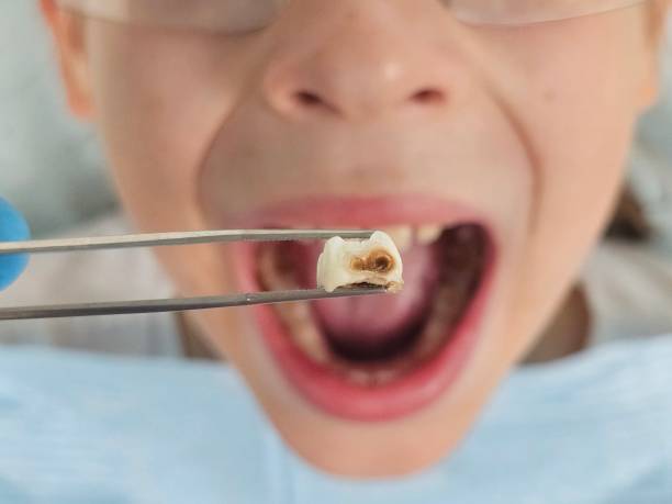 Best After-Hours Emergency Dentist in Palacios, TX