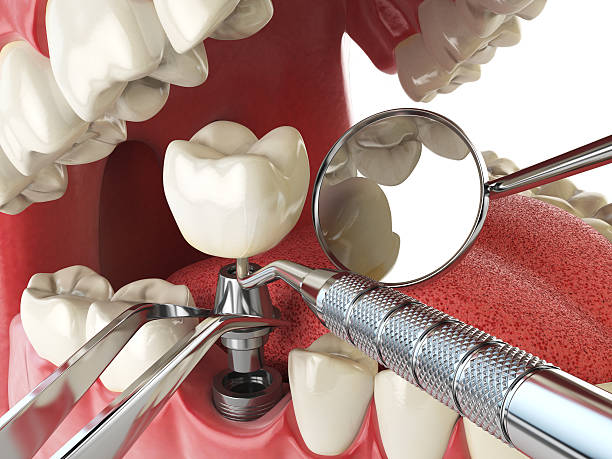 Best Emergency Broken Tooth Repair in Palacios, TX